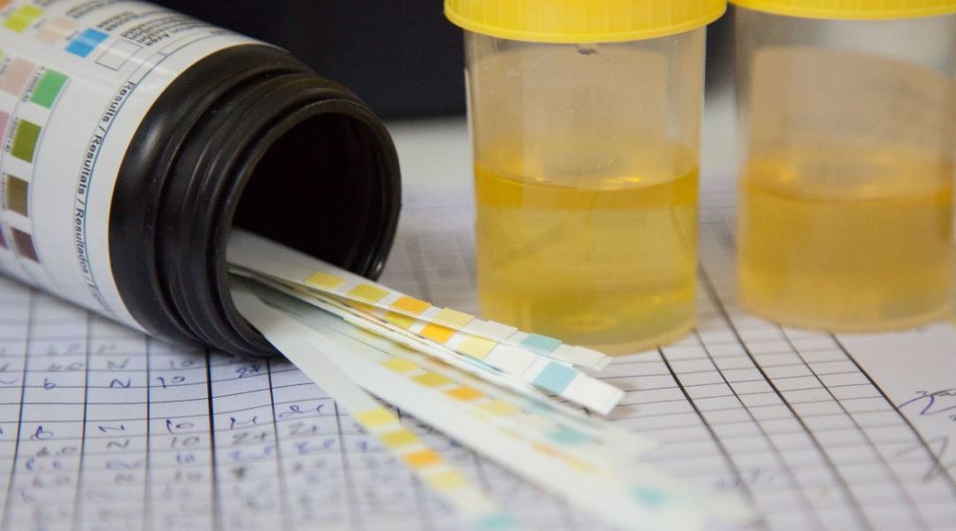 Do Marijuana Detox Drinks Actually Work for Drug Tests?